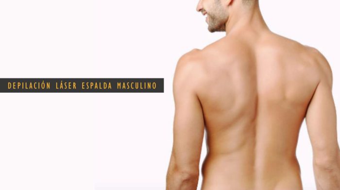 Depilación Láser Espalda (Masculino)
