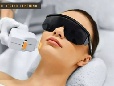 DEPILACIÓN-ROSTRO-FEMENINO