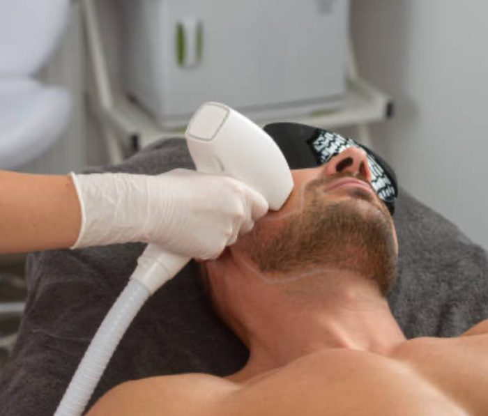 PACK 6 SESIONES DEPILACIÓN TRILÁSER ROSTRO COMPLETO + CUELLO ANTERIOR MASCULINO